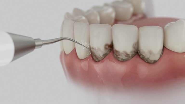 Reliable Dental contractor in Topeka, IN by Dentist Open Now